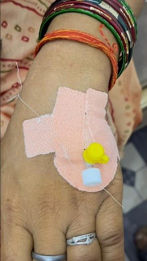 How to easily remove IV cannula | IV cannula removal