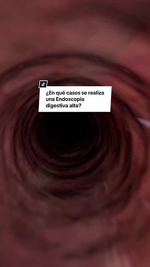 🌟 Descubre todo sobre la Endoscopia Digestiva Alta 🌟 ¿Qué es? Es un procedimiento médico que permite examinar el interior del esófago, estómago y duodeno utilizando un endoscopio flexible. ¿En qué casos se debe realizar? Se realiza para diagnosticar, tratar y prevenir diversas afecciones gastrointestinales, como úlceras, inflamación, sangrado, reflujo ácido, tumores y otras anomalías. ¡No temas a la endoscopia! Es una herramienta crucial para el diagnóstico temprano y el tratamiento de enferme