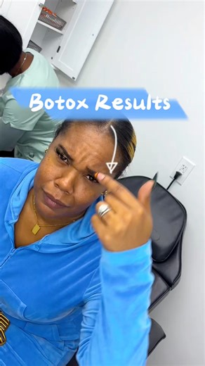 Botox Before & After 💉😝 Stay Tuned for Full Session #toledo #wellness #spaday #botox #transformation | Brittany Shaw