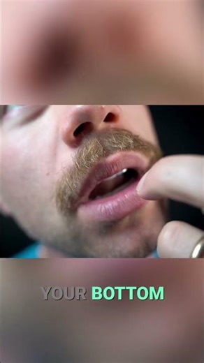 Do You Have an Overbite? Dentist Explains! #fyp #asmr #sleepsolution #asmrtriggers #relax