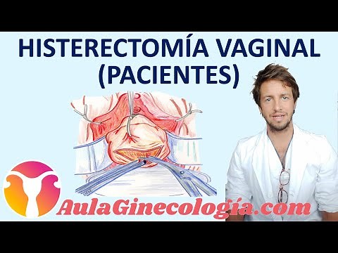 HISTERECTOMÍA VAGINAL (PACIENTES): quitar la "matriz": CIRUGÍA, CUIDADOS - Ginecología y Obstetricia