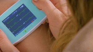 EMAY 6L Portable 6-Lead ECG Monitor: Wireless Heart Health Tracking & Instant Results