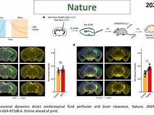 Nature—脑代谢废物清除研究重磅：神经活动驱动CSF灌注和脑代谢废物的清除_哔哩哔哩_bilibili