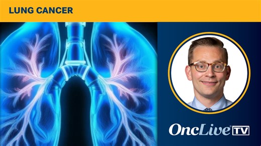 Dr Iams on the Optimal Management of LEMS in Patients With SCLC | OncLive