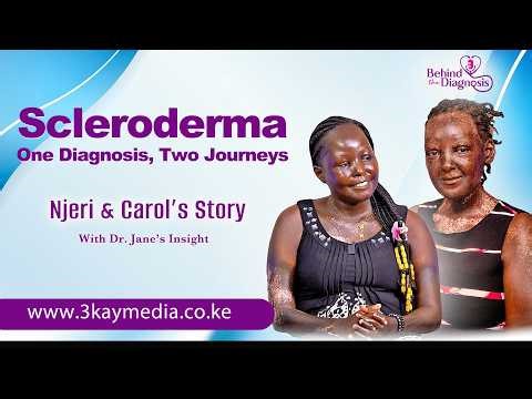 Scleroderma: One Diagnosis, Different Journeys.