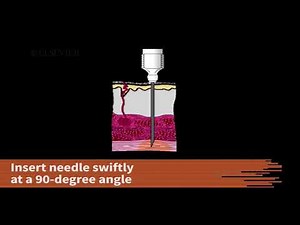 Administer a Pediatric Intramuscular Injection into the Vastus Lateralis Muscle​