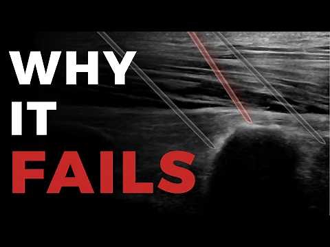 Why Your ESP Block Fails (And How To Fix It)