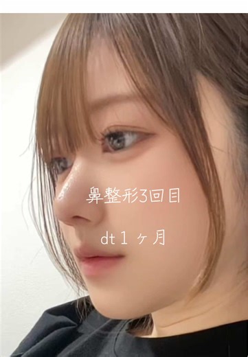 遠回りしちゃった #02 #鼻整形 #音声効果チャレンジ