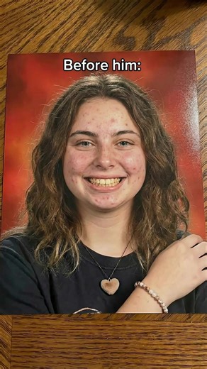 My Glow Up #glowup #beforeandafter #mog | glowup