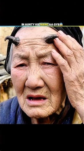 She GREW Real Horns 😱