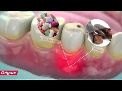 How Colgate Pain Out Works