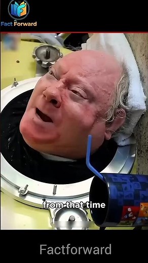 He Lived 73 Years Inside a Machine! 🤯🚨💔