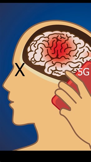 What happens when 5G hits your body? 🤓 #absorption #scientificmethod #waves #mechanics #professional #fblifestyle #reels | The Action Lab