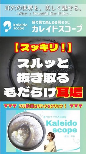 【スッキリ】スルッと抜き取る毛だらけ耳垢