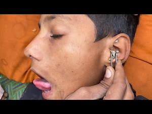 ASMR Ear Cleaning for Deep Relaxation & Sleep | Ultra Soothing Ear Wax Removal Sounds: ASMR Niki