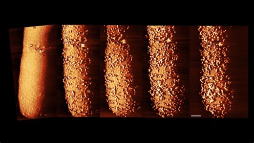 Striking images capture an antibiotic slaying bacteria in real time