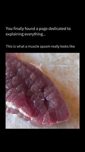 3.4M views · 16K reactions | What a muscle spasm really looks like! #reels #explore #memes | Explaining Everything | Facebook