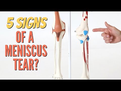 5 Signs Your Knee Pain is a Meniscus Tear-Self-Tests (Cartilage) Updated