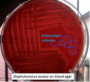 Beta hemolytic colony of Staphylococcus aureus on Blood agar and this