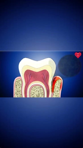 Root Scaling And Planning #dentalcare #dentist