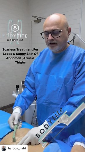 BodyTite for body contouring using radio frequency energy to contour skin and remove fat at Dr Haroon Nabi’s clinic in Lahore. @haroon_nabi @inmodeaesthetics @inmode.international | Academy of Aesthetics