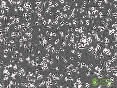 Time-lapse of Neurite Outgrowth of Plated iCell® Neurons