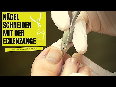 FUSSNÄGEL schneiden mit der Eckenzange | So schneidest du NAGELECKEN richtig! | PODOLOGIE