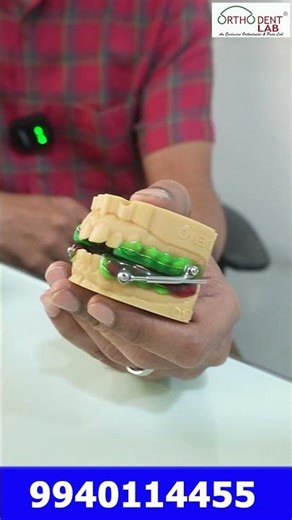 Herbst Appliance Mechanism, Indications & Clinical Effects