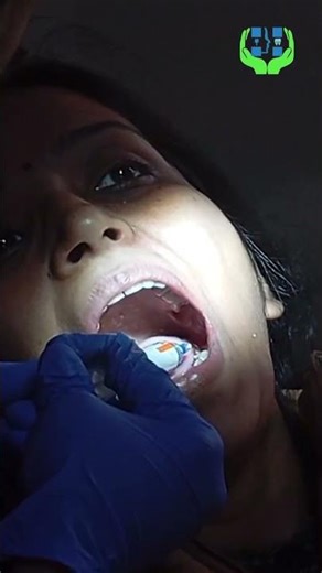 Cosmetic Teeth Filling in Patna | Natural Tooth-Colored Filling by Dr. Archana Rani