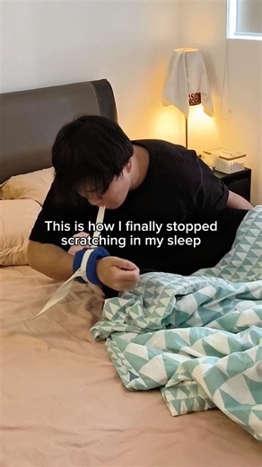 breaking the itch-scratch cycle 💯 #eczema #eczemamitten #eczemacare #eczemaawareness #eczemaflareup