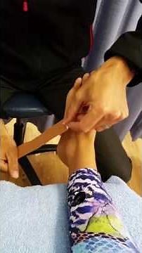 Lateral Foot Pain Taping SportsMed Podiatry