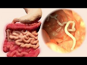 Nematode Navigations: A Dive into Gastrointestinal Parasites (4 Minutes)