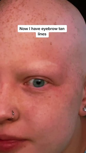 HAHAH look at my eyebrows tan lines #makeup #alopecia #tanlines #makeupartist
