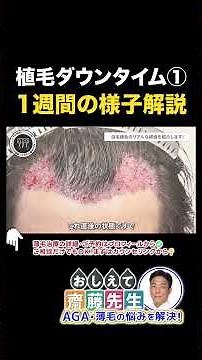 [Warning: Graphic Content] Explanation of the appearance of the scalp one week after hair transpl...