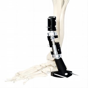 [Hot Item] Orthopedic External Fixator Ankle External Fixation