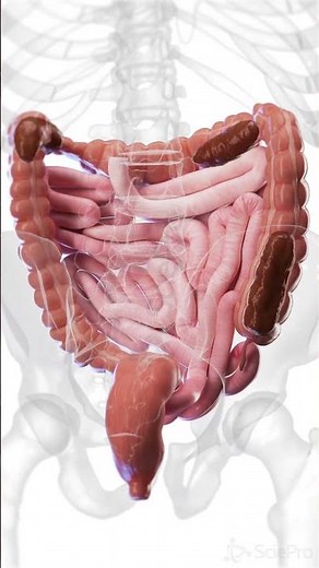 What Happens Inside Your Colon During Constipation #Shorts #Anatomy