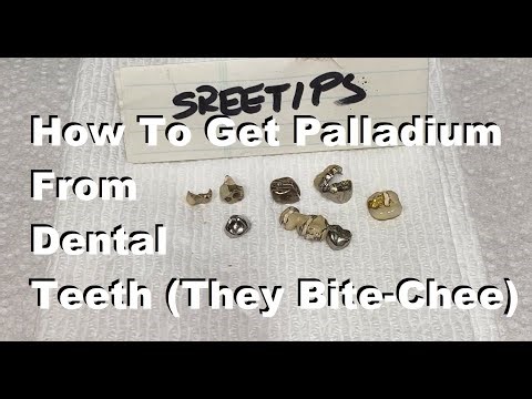 How To Recover Platinum Group Metals From Dental Scrap Pt1