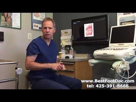 Alcohol Injection for Morton's Neuroma -- Uses, Success Rate, Recovery