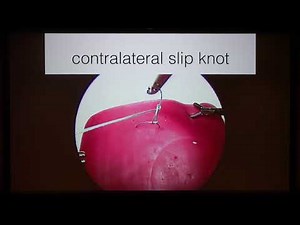 Square knot, Slip knot and Surgeon's knot • Video • MEDtube.net