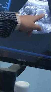 17weeks Ultrasound baby