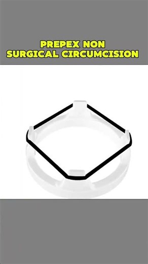 Prep #PrePexcircumcision #NonSurgicalCircumcision #MaleCircumcision #PrePexDevice #SafeCircumcision