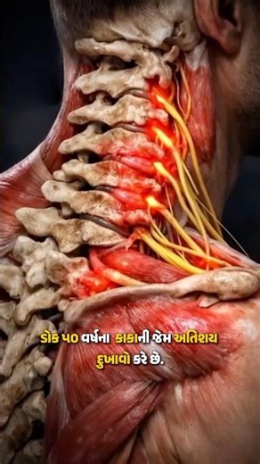 #neckpain #cervicalspine #spine #muscle #pain #headache #painrelief #musculação #musclebuilding