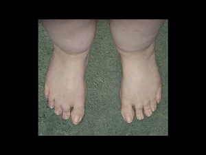 How To Increase Blood Flow & Circulation To Your Feet Do You Suffer Poor Circulation