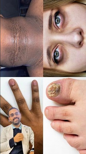 12 Common Skin Issues You Must Fix 👉 #faceserum #glowingskin #pigmentation