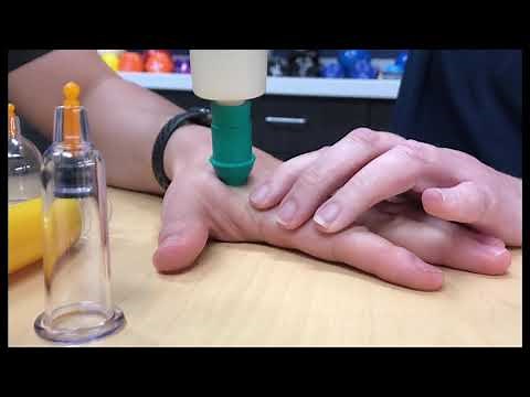 CUPPING FOR THE HAND