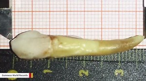 Dentist sets Guinness World Record, pulled the world's longest tooth