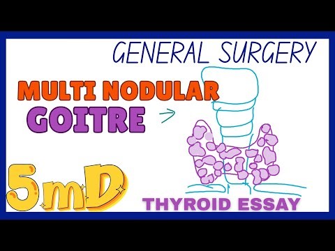 MULTINODULAR GOITRE - GENERAL SURGERY - ESSAY - easy notes - quick explanation ! 5mD
