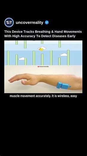 This Technology Tracks Breathing & Hand Movements To Detect Disease Early. Here's How #tech #shorts