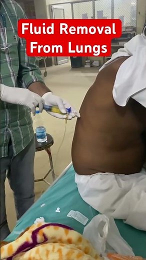 | Lung Fluid Extraction Procedure by Doctors | Medical Video | Thoracentesis Explained
