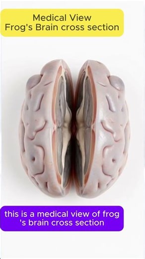 Medical View Frog's Brain cross section